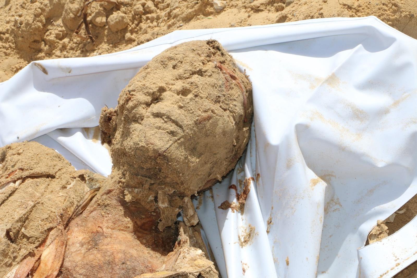 martyr exhumé depuis un cahrnier à l'hôpital de Naceur à Gaza