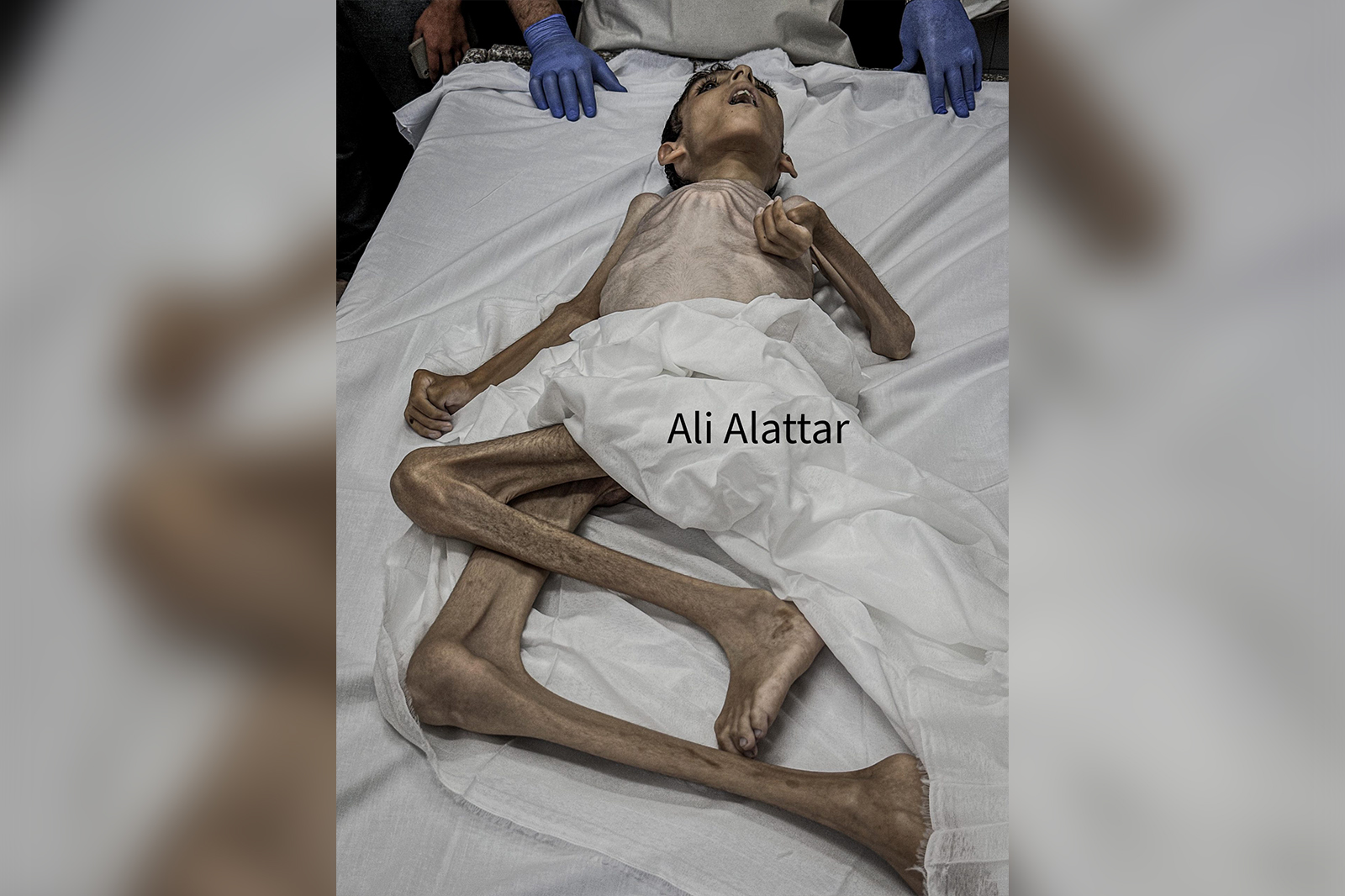 enfant gazaoui mort à cause de la famine