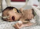 enfant mort à Gaza à cause de la faim