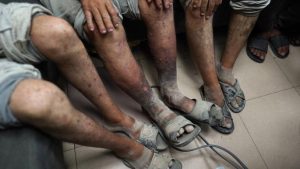 détenus palestiniens face à prolifération de la gale